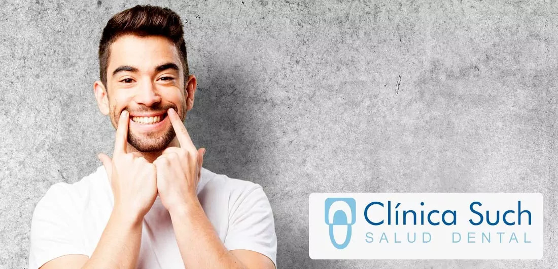 Limpieza dental en Clínica Dental Such
