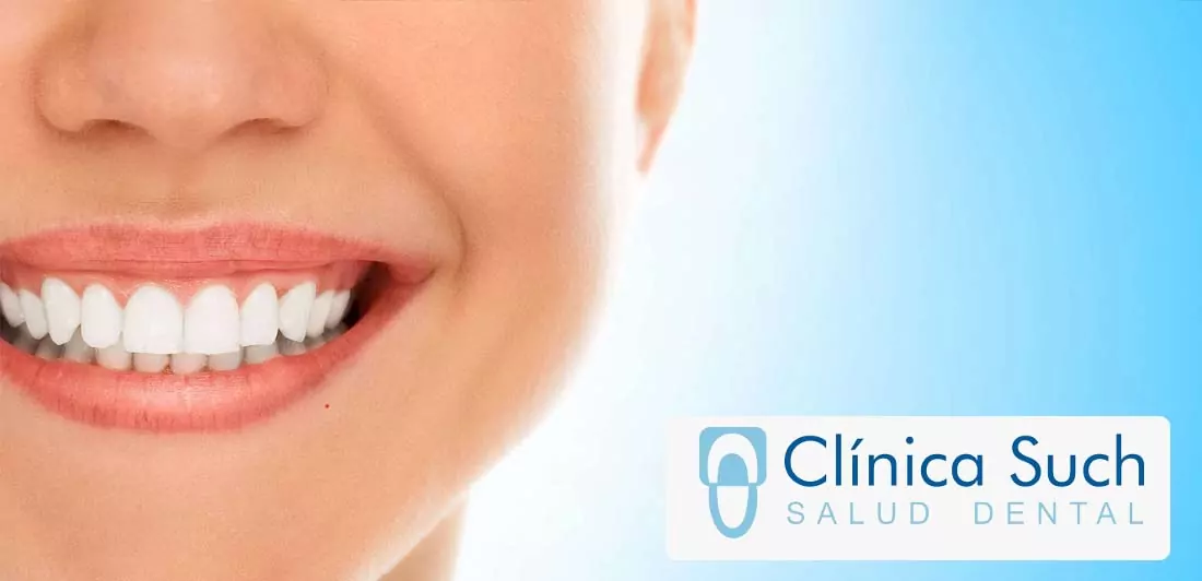 La importancia del cuidado de los dientes