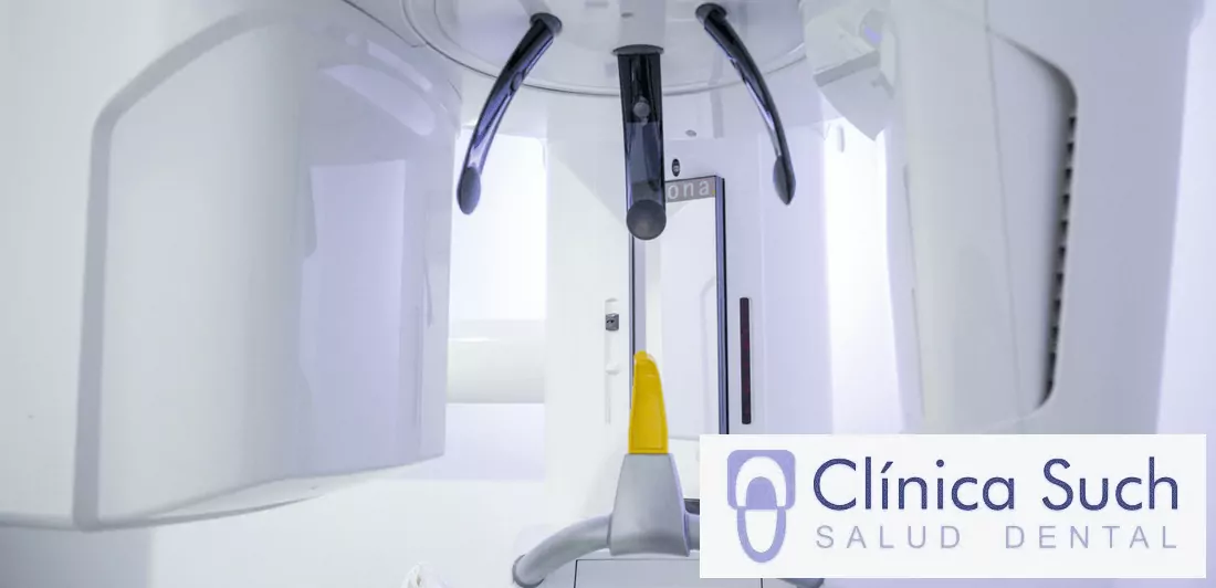 TAC dental para planificar cirugía oral en Valencia