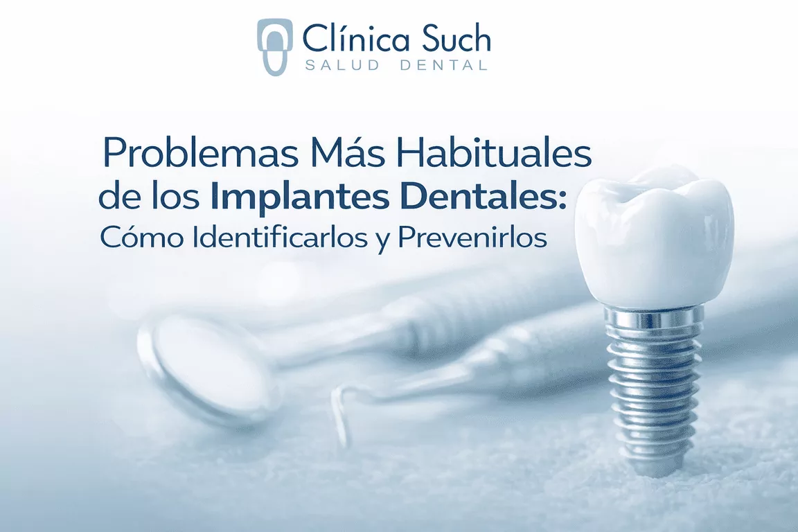 Problemas más habituales de los implantes dentales