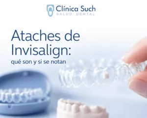ataches de invisalign: Tratamiento de ortodoncia invisible