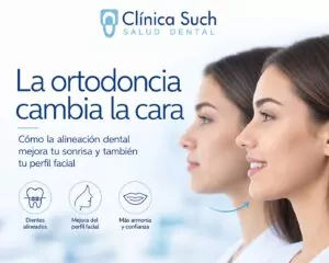 ¿La ortodoncia cambia la cara? Qué cambia de verdad en tu perfil (y qué no) Por la Dra. María García Obeso — Odontóloga · Ortodoncia y ortopedia dentofacial | Clínica Dental Such, Valencia