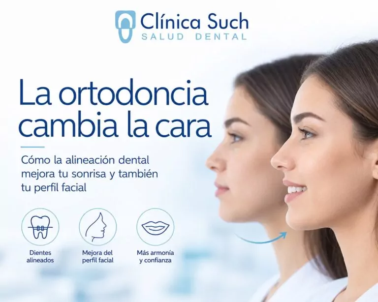 ¿La ortodoncia cambia la cara? Qué cambia de verdad en tu perfil (y qué no) Por la Dra. María García Obeso — Odontóloga · Ortodoncia y ortopedia dentofacial | Clínica Dental Such, Valencia
