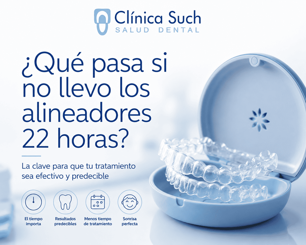 ¿Qué pasa si no llevo los alineadores las 22 horas? Invisilign ortodoncia invisible en valencia