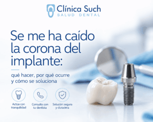 Qué hacer si se te cae la corona del implante dental en Valencia por el Doctor Joan Such Odontólogo experto en implantología dental en Valencia