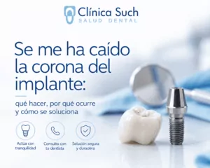 Qué hacer si se te cae la corona del implante dental en Valencia por el Doctor Joan Such Odontólogo experto en implantología dental en Valencia