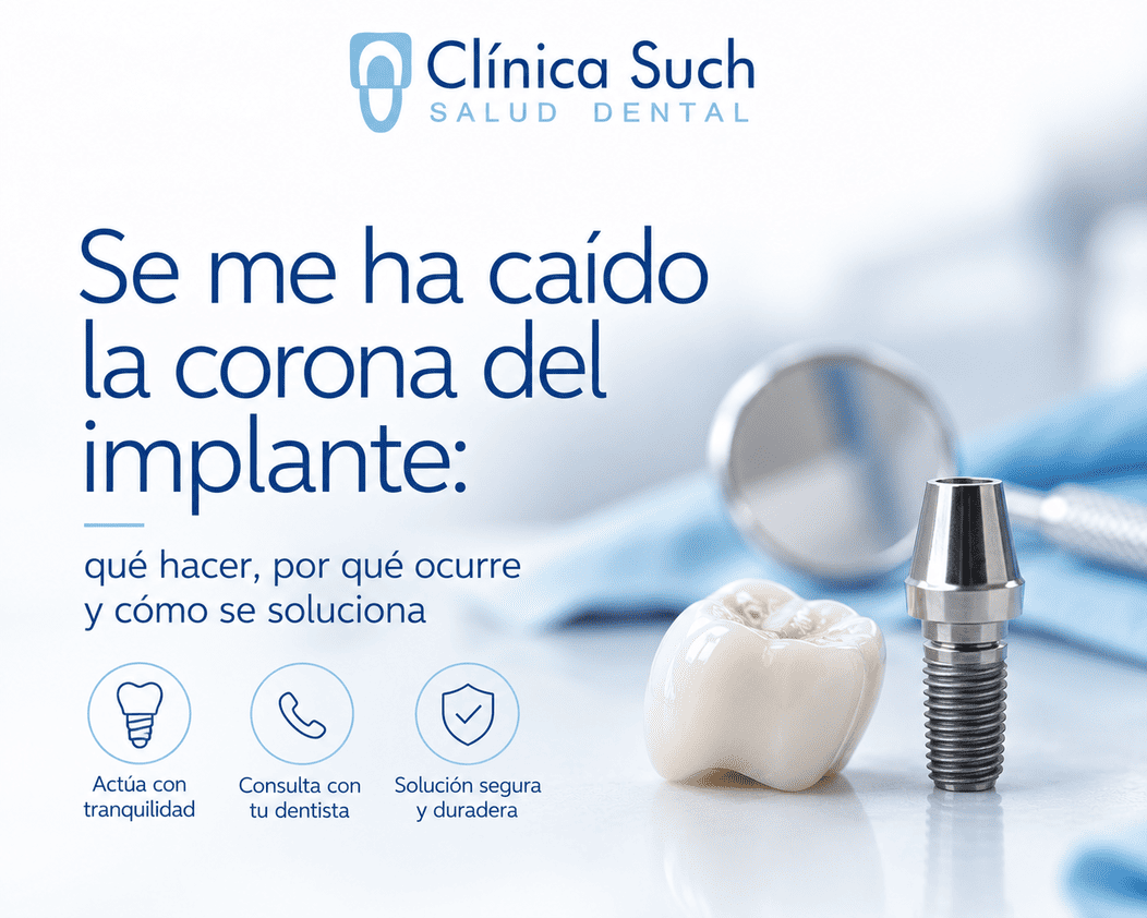 Qué hacer si se te cae la corona del implante dental en Valencia por el Doctor Joan Such Odontólogo experto en implantología dental en Valencia