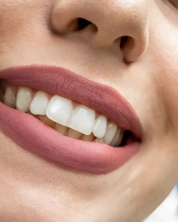 Sonrisa con los dientes blancos