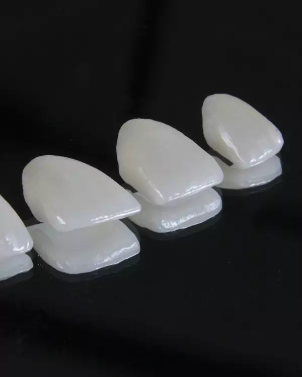 Carillas dentales de porcelana sobre fondo oscuro