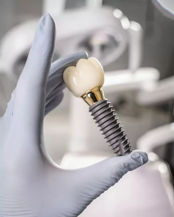 Implante dental con su corona sujetado con guante