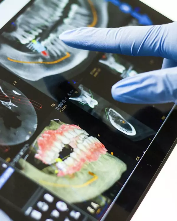 Estudio de TAC dental en 3D en una tableta
